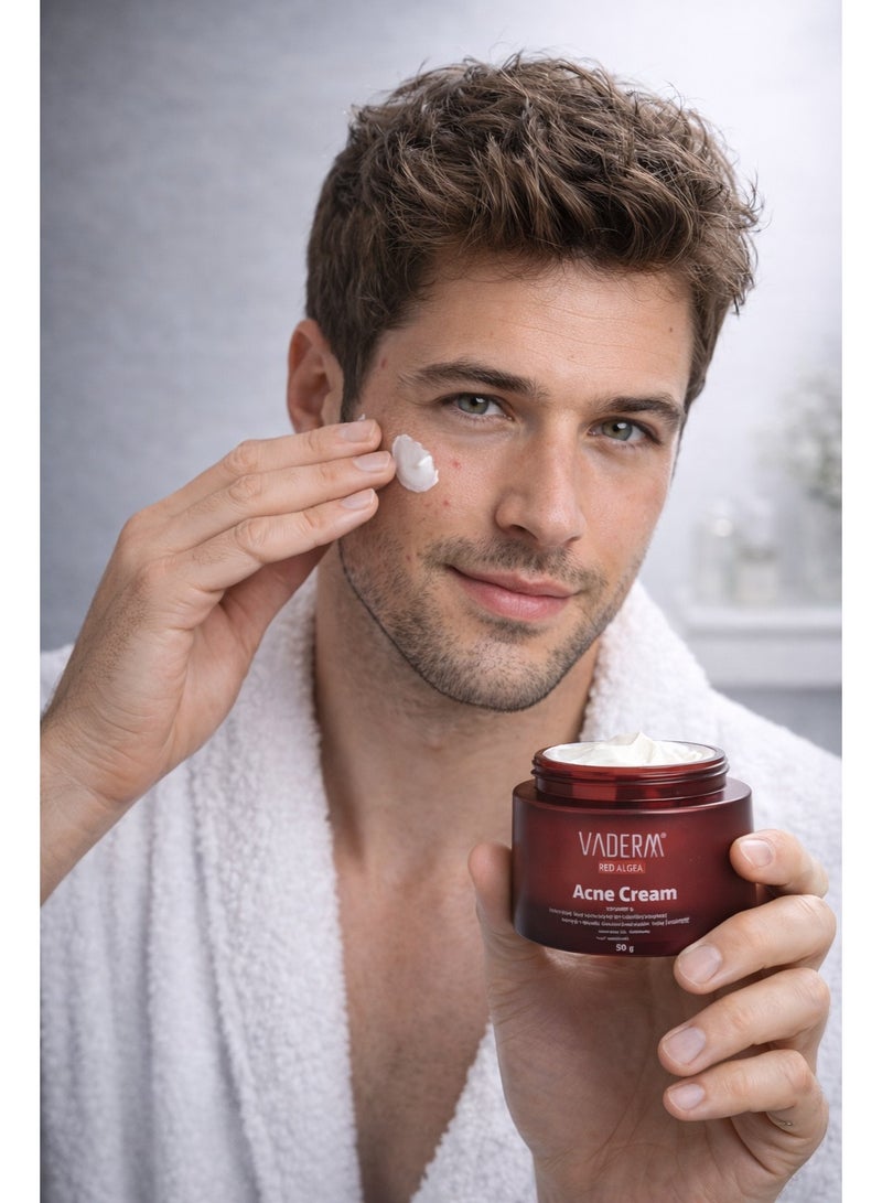 VADERM Red Algae Acne Cream 50g – Advanced Blemish Control with Azelaic Acid, Salicylic Acid & Sulfur - Image 4